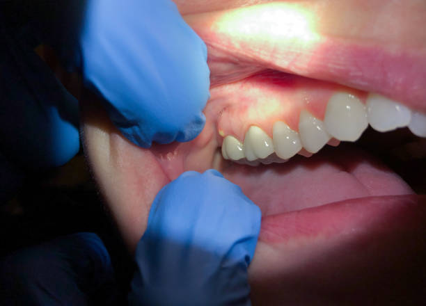 Best Pediatric Emergency Dentist in Highland Village, TX