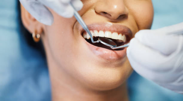 Best Emergency Dental Care for Broken or Chipped Teeth in Highland Village, TX
