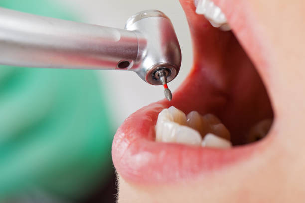 Best Pediatric Emergency Dentist in Highland Village, TX